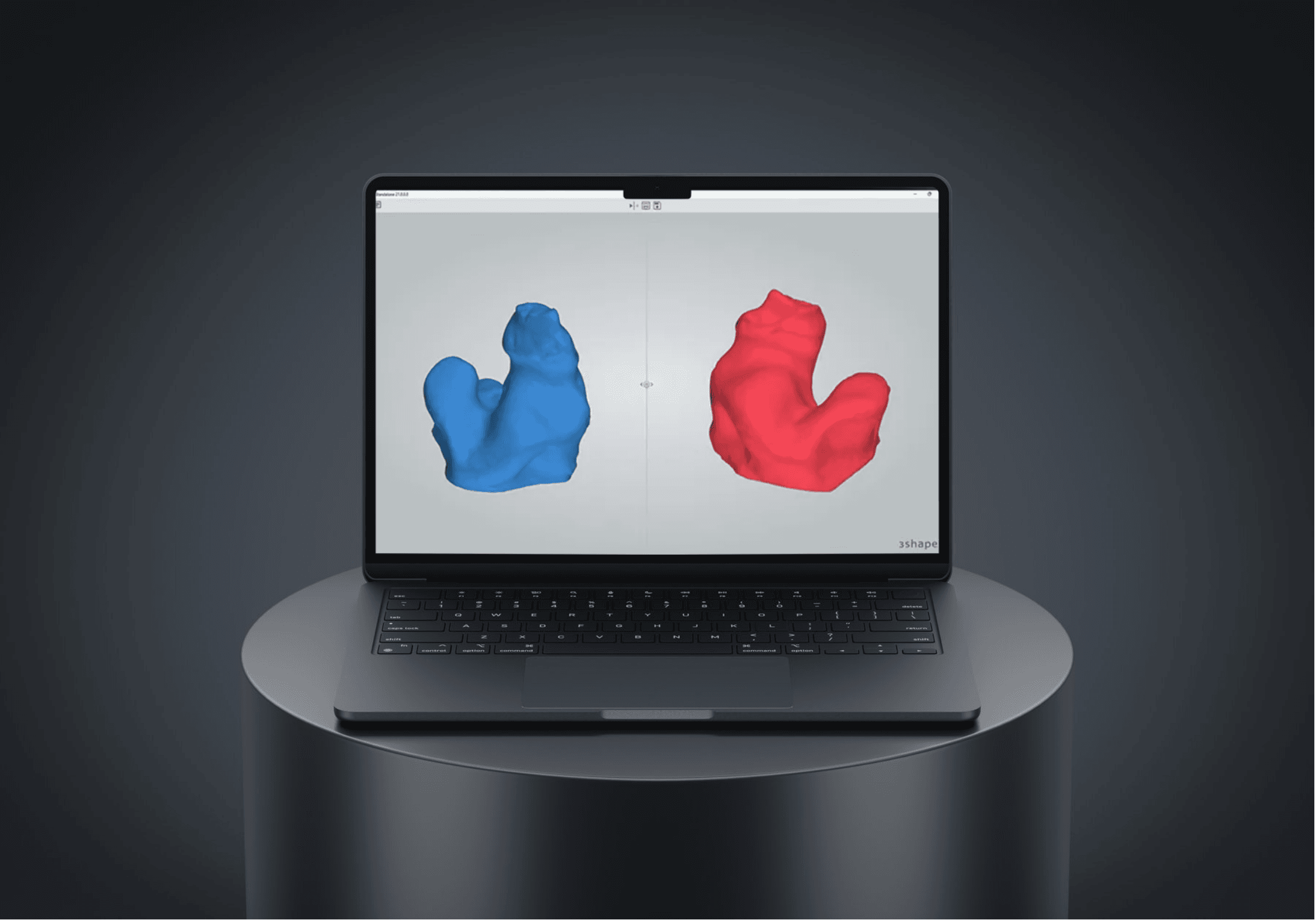 Etapes 3Shape.png